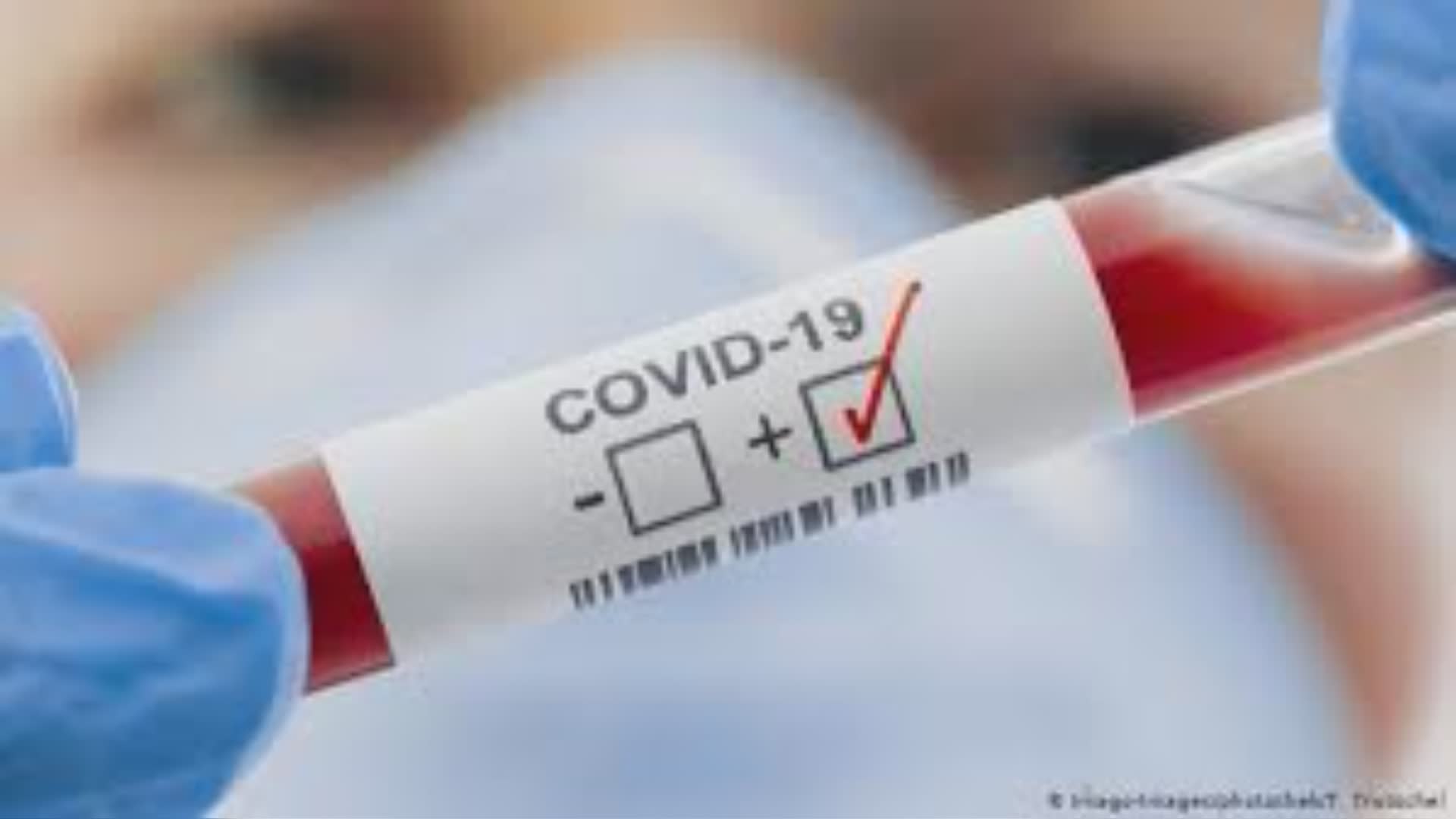 Covid: più positivi e una nuova vittima