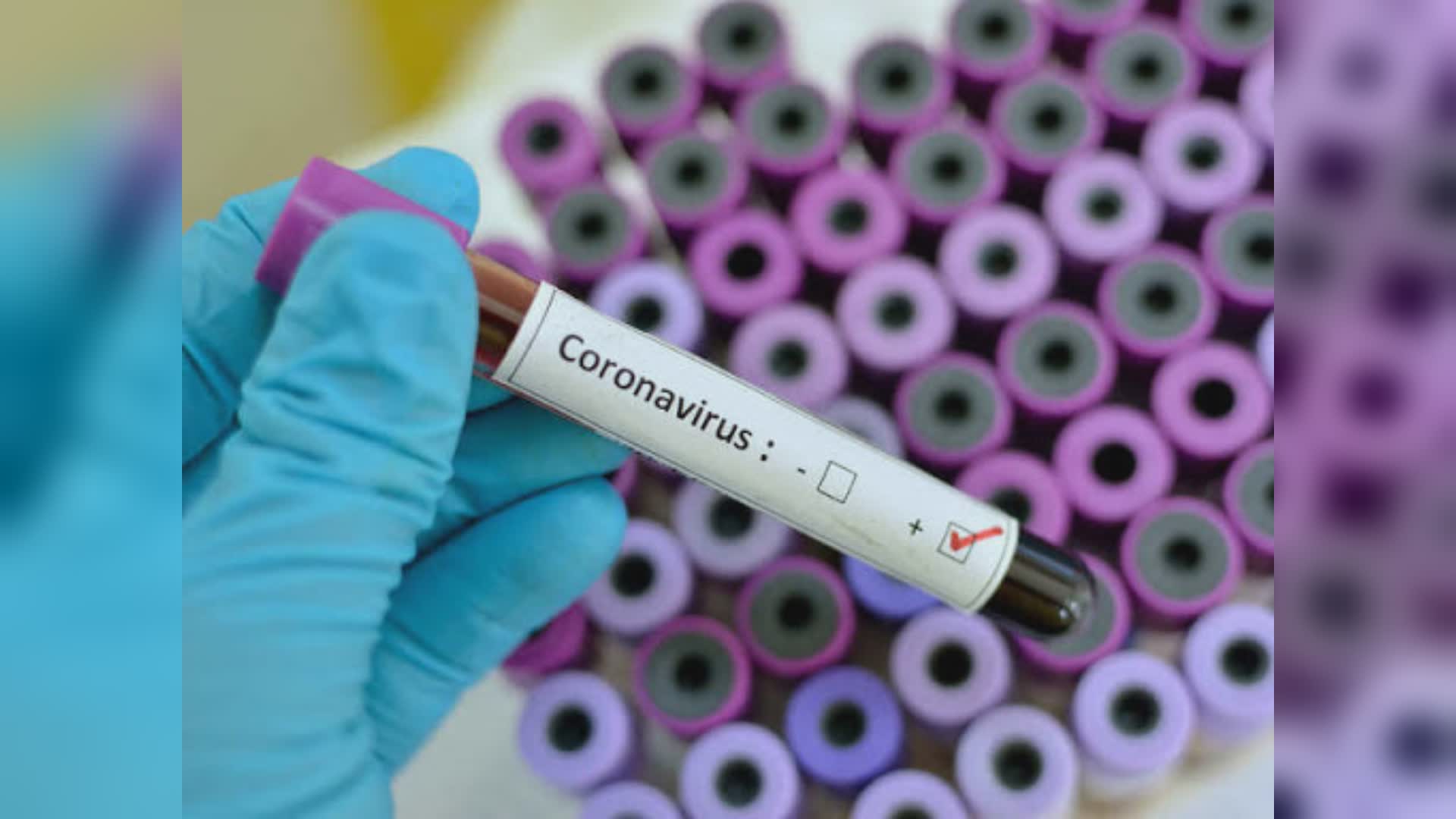 Covid, 3 nuove vittime ma ricoveri stabili. Vaccinati sopra 78%