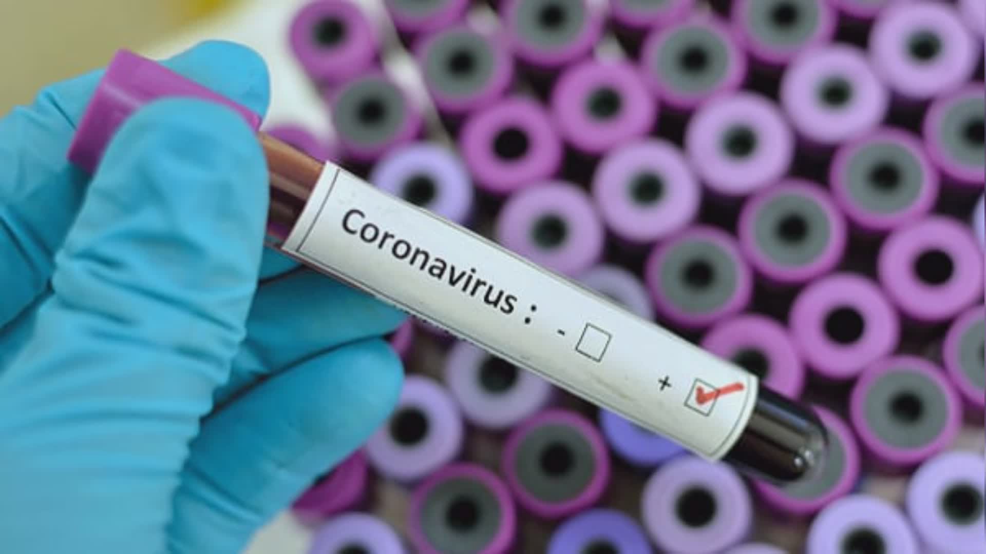 Coronavirus, altri 18 nuovi casi nelle ultime 24 ore